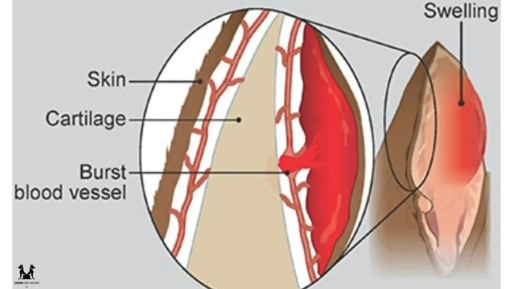 Diagnosing Ear Hematomas